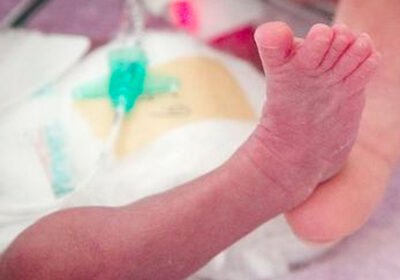 Dr. Thérèse Perreault holds up the foot of premature baby in the Royal Victoria Hospital’s Neonatal Intensive Care Unit.
PHOTOGRAPH BY: PIERRE OBENDRAUF , THE GAZETTE